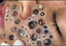 How to treat female hair loss